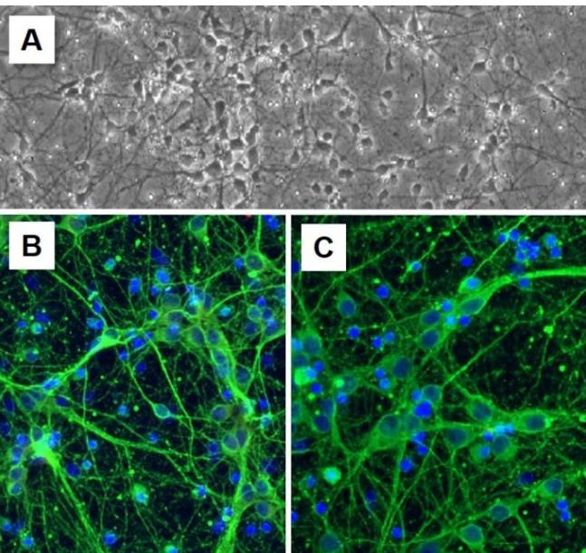 大脑中的电怎样释放,大脑消耗什么产生电