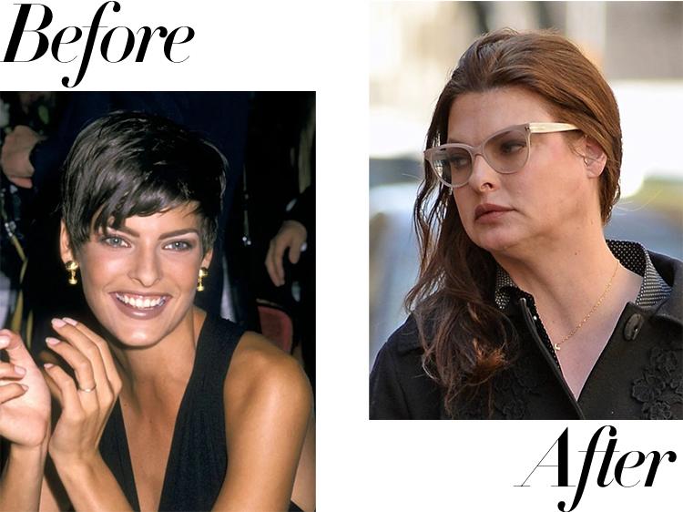 那个曾经没有10000美金不起床的超模，被医美毁容了