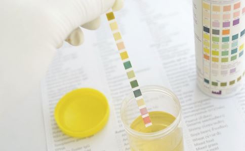 乙肝患者胆红素数值正常说明什么,乙肝尿黄是肝硬化吗