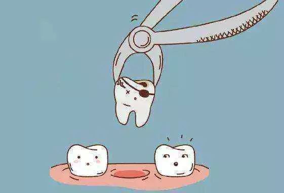 牙齿松动到什么程度必须要拔牙呢,牙齿严重松动要拔牙吗