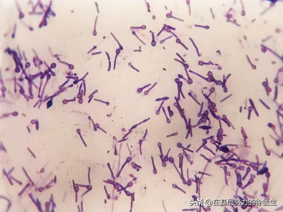 认识破伤风手抄报,你知道破伤风有多可怕吗