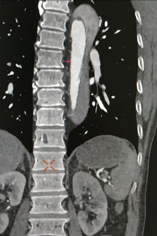 d-二聚体测定正常吗,颠覆认知免费阅读全文