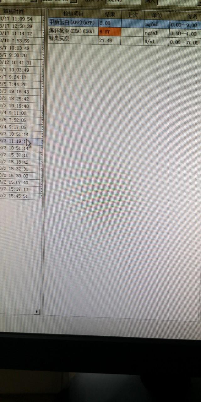 中西医结合治疗原因不明肠梗阻、腹水转氨酶明显升高病案一例！