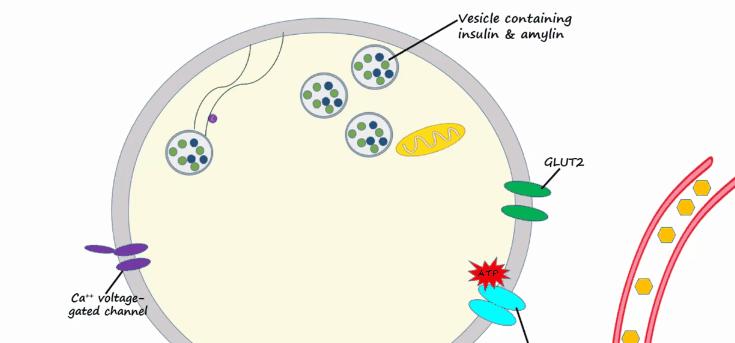 胰岛素是如何导致糖尿病的,胰岛素增多为什么会导致糖尿病