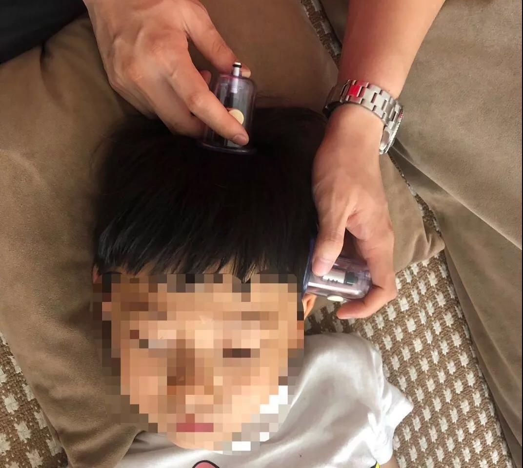 小孩腺样体肥大可以中药调理好吗,孩子腺样体肥大容易上火怎么调理