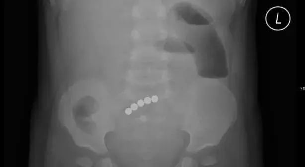 千万不要给孩子玩网红玩具,家长必须记住孩子玩的危险玩具