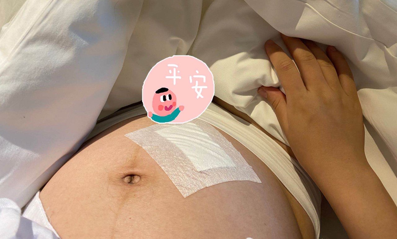 羊水穿刺正常四维就安全了,羊水穿刺后如何保证胎儿安全