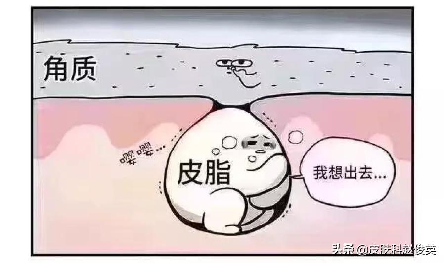 疮疡病病人的症状,疮是怎么引起的怎么治