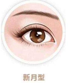 你适合哪种双眼皮类型,你适合哪种双眼皮