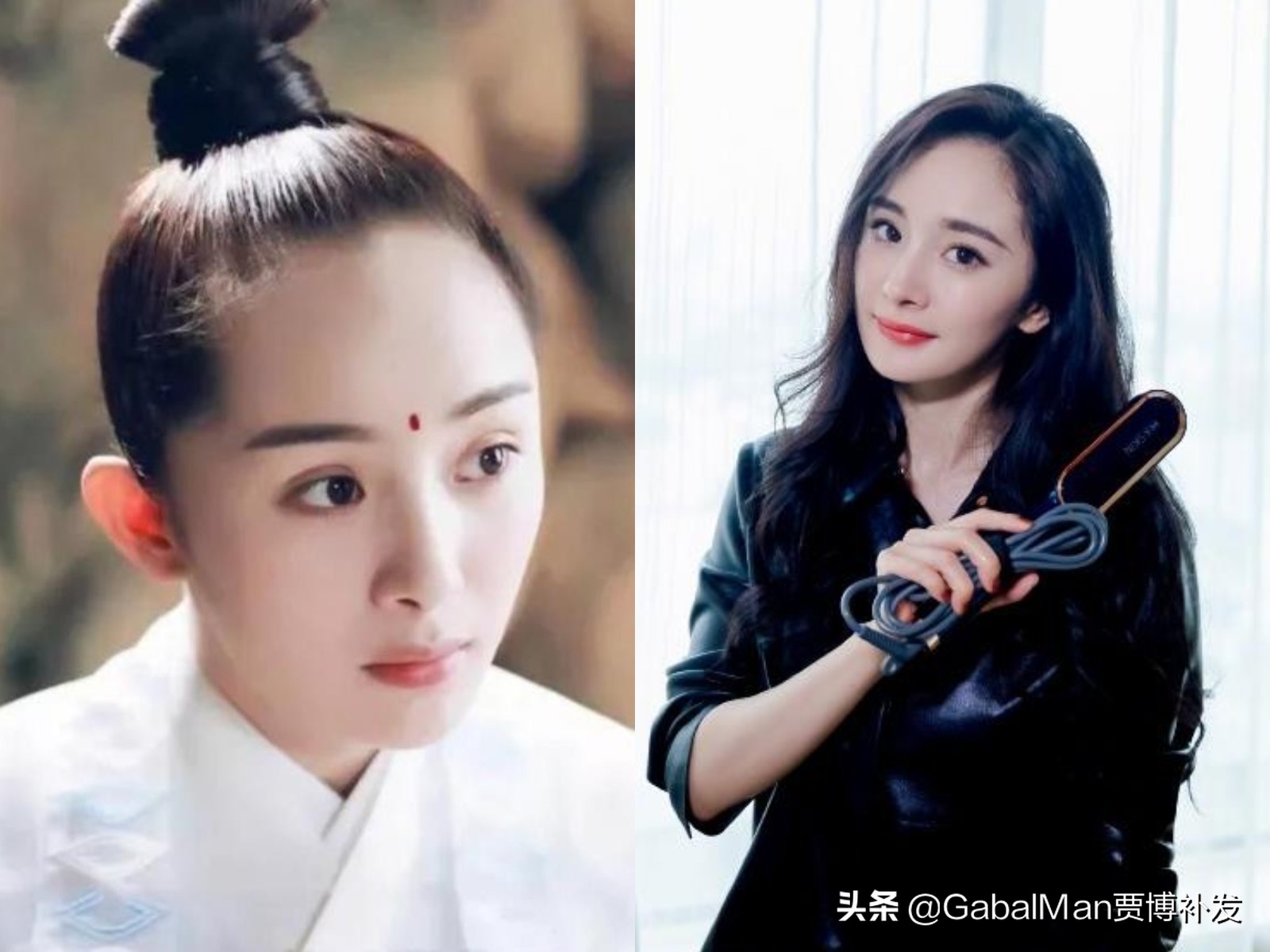 拯救发际线的最佳方法,如何拯救发际线过高