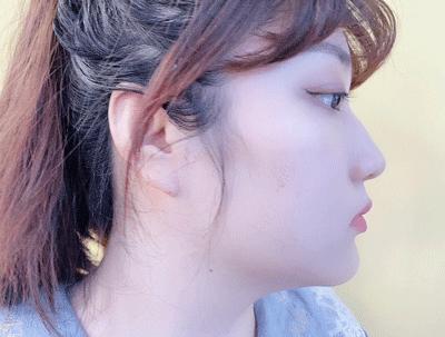 脸上老是长痘痘用什么药,脸上痘痘反复最快的解决方法