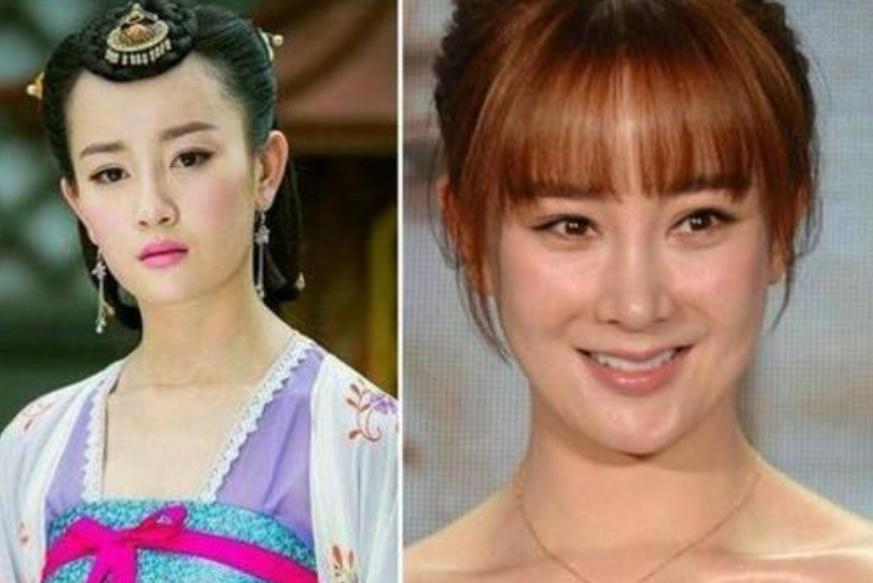 美容针美容的误区,为美而整容最后付出的代价