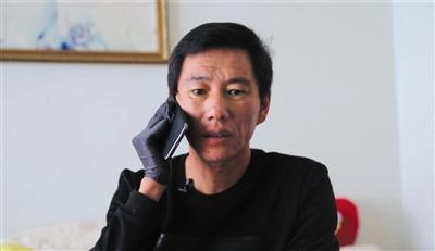 捡到核辐射链子的受害者医药费,首例核辐射受害者