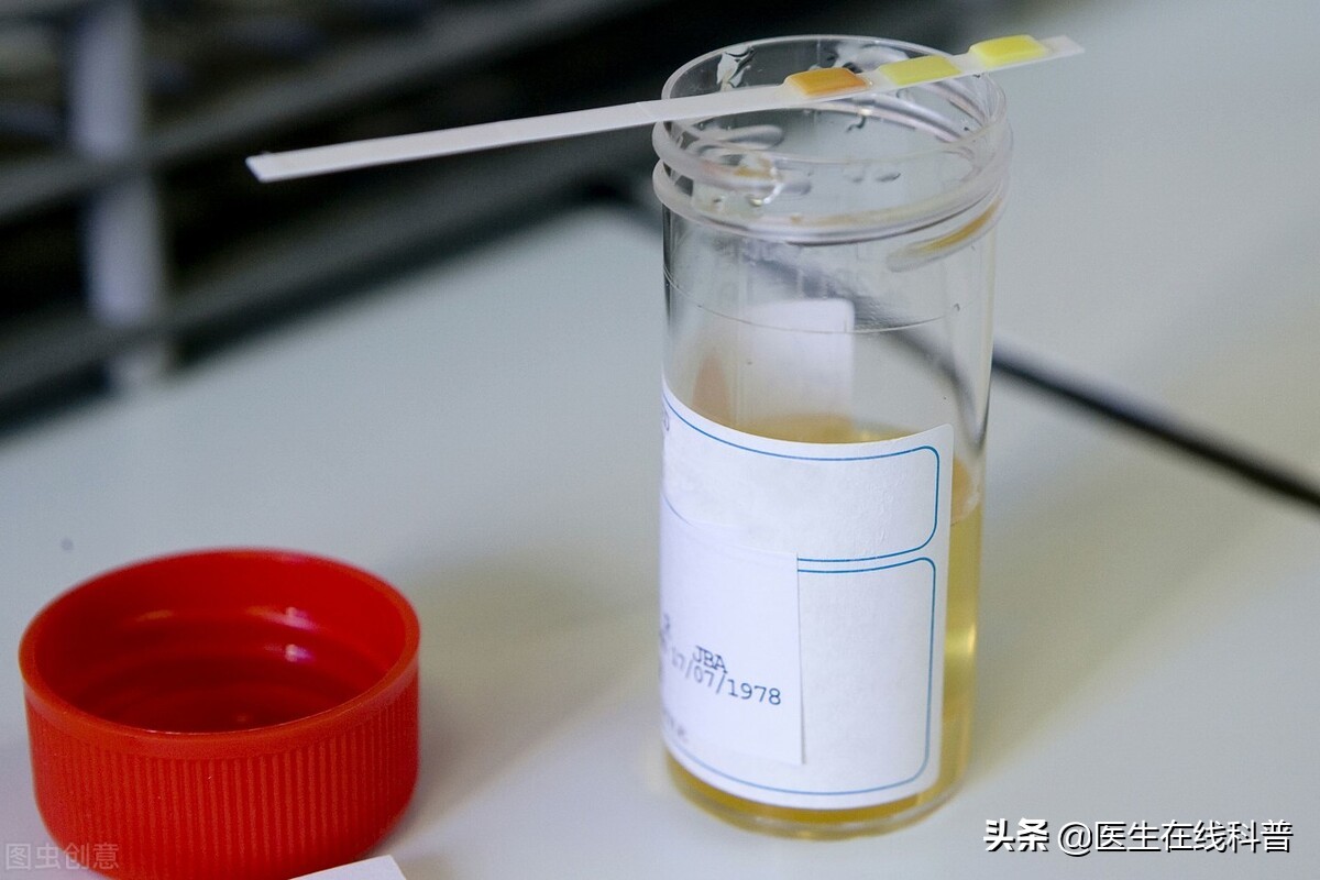 8岁小孩肾病综合征能彻底治愈吗,肾病综合征刚停药就复发