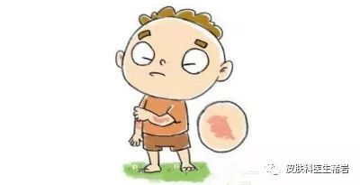 湿疹到底长什么样,手脚湿疹长什么样