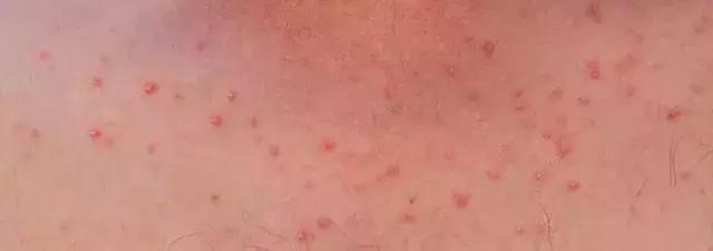 夏天就要心机露肤才更显瘦,又到了夏天露腿露肩的季节