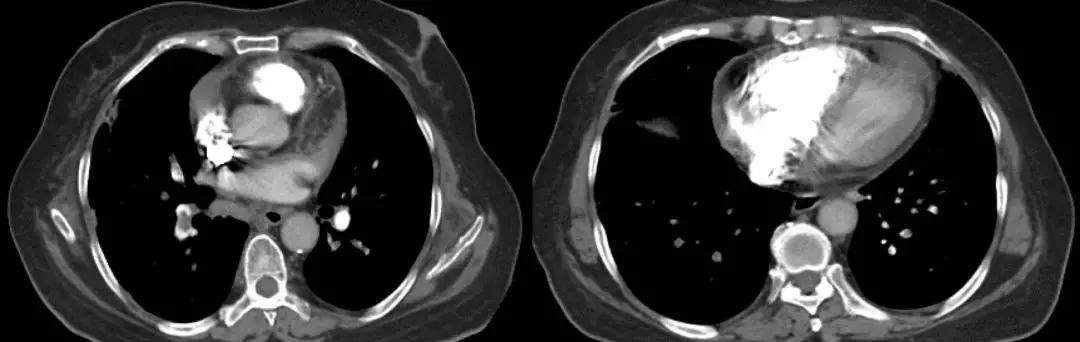 抗菌药物不合理处方分析,抗菌药物用药不合理的表现