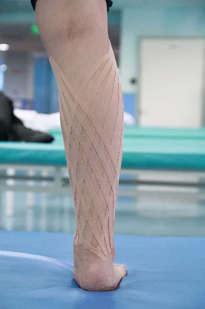 弹性贴布的原理,弹性贴布的作用