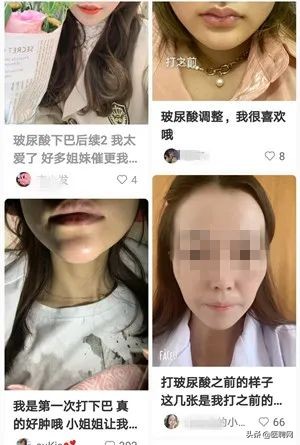 整形外科医生工资一般多少,整形医院皮肤科的工资高吗