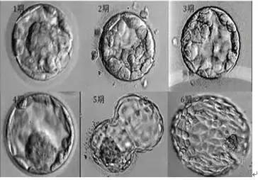 一级冻胚解冻降级的可能性,冻胚降级后能着床吗