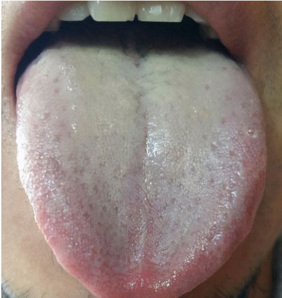 身体哪些部位出现青筋需要注意,身体4个部位出现青筋要提高警惕