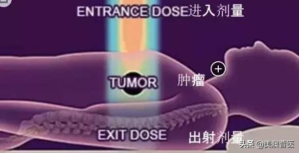 李宗伟质子重离子完全治好了吗,李宗伟退役中文版