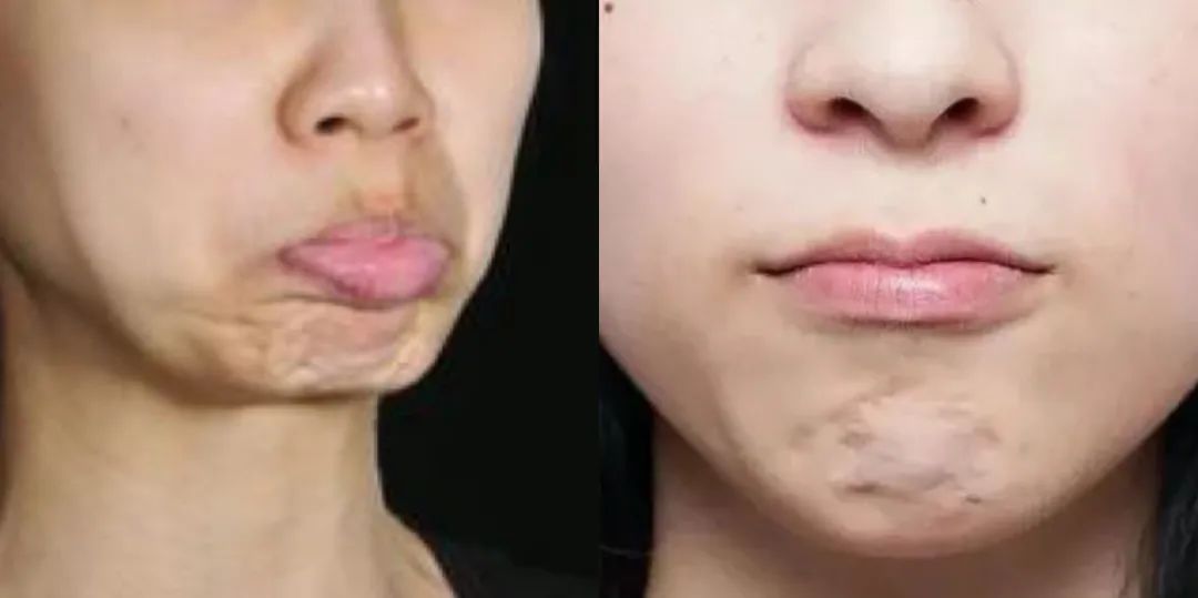 下巴宽厚的人,头尖下巴宽厚