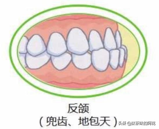小孩子常见牙齿问题有哪些,孩子牙齿出现问题该不该去医院