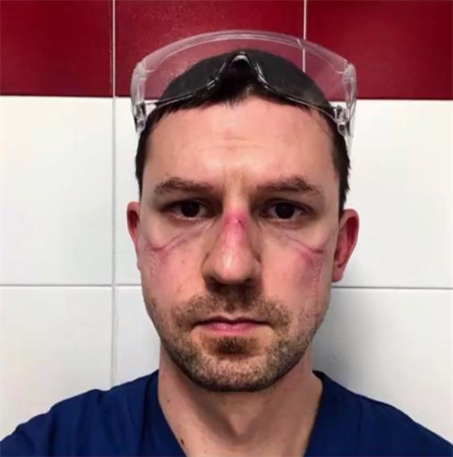 戴口罩的热点话题,热门话题戴口罩