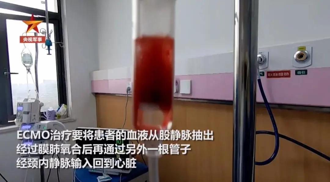 深入“红区”，直击ECMO上机治疗全过程：生死营救5小时，医生跪地抢救…