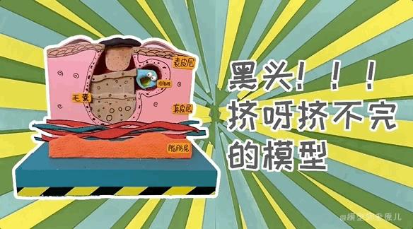 模型师老原儿手被烫伤,模型师老原儿被烫伤