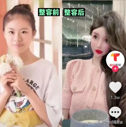 女子打童颜针长脓包3年没工作,女子打水光针花了17万