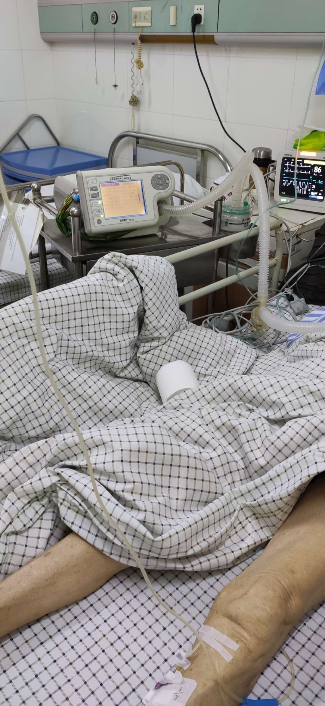 睡觉鼾声如雷精神崩溃,晚上睡觉鼾声特别大而且不规律