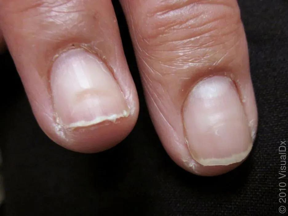 美甲的指甲怎么养护才好看,如何不做美甲就能让指甲变得精致