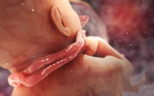 脐带绕颈胎儿会有危险吗,胎儿脐带绕颈需要剖腹吗