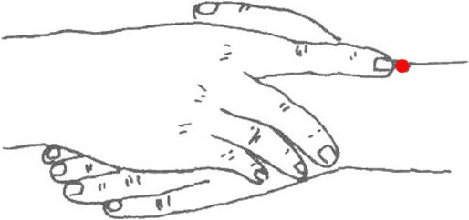 颈项痛的病因,左颈项痛