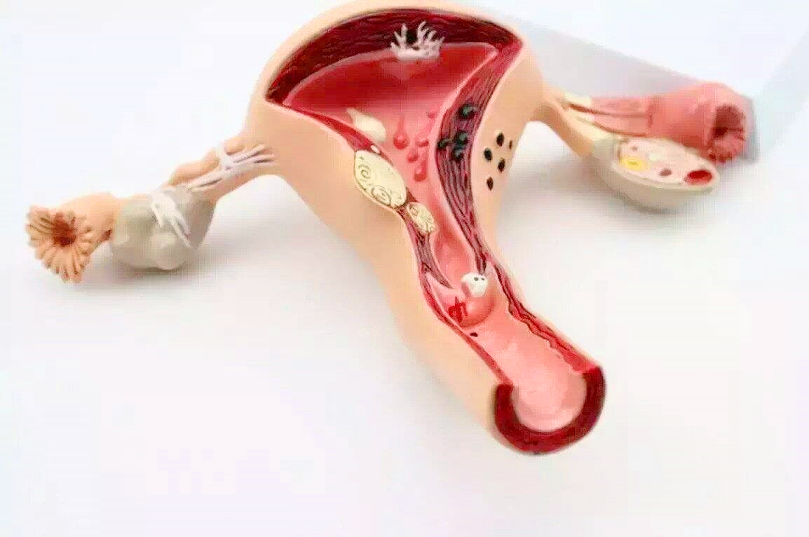 女人子宫摘除，和正常人有什么区别？医生给出了明确答案