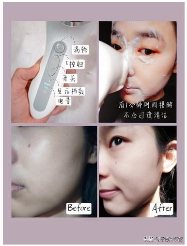 清洁泥膜去黑头美白推荐,eiio泥膜可以去黑头吗