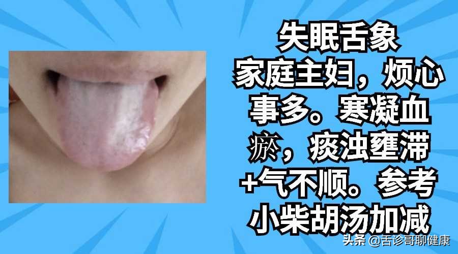 舌诊歌舌象分析和感悟,舌诊歌舌象分析及感悟