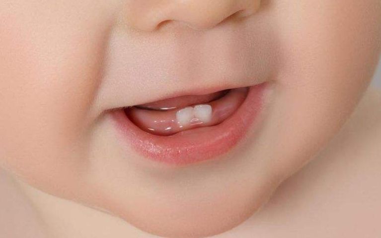 儿童牙齿如何保护防止蛀牙,预防小孩牙齿蛀牙最好做保护方法