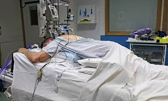 新冠痊愈巨舌症,美国新冠后遗症患者自述巨舌症