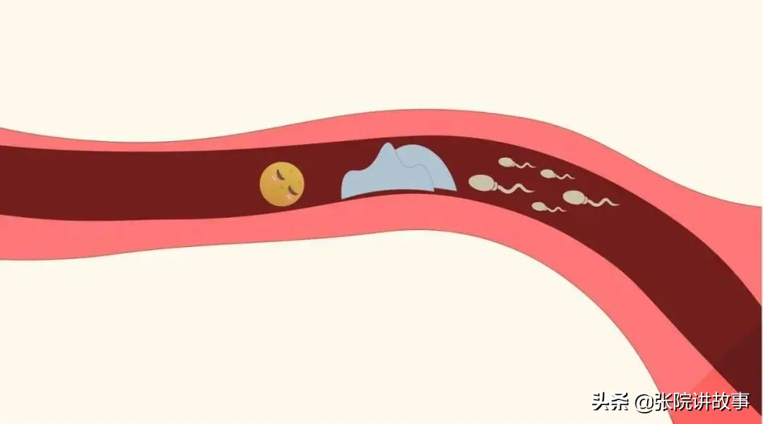 「张院讲故事」输卵管不是下水道!千万不要随便通!损伤不可逆