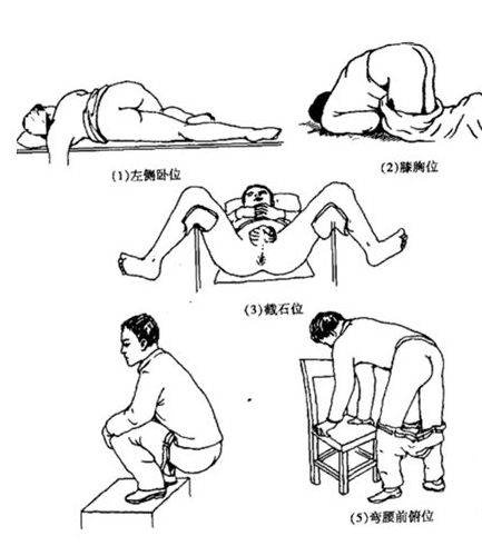 新冠咽拭子结果,新冠咽拭子阳性参考标准