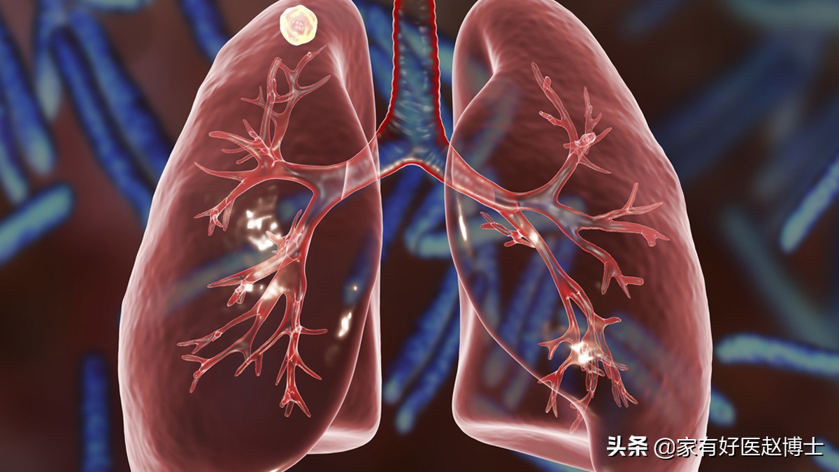 体检报告中常出现钙化哪些需警惕,钙化有什么症状和危害