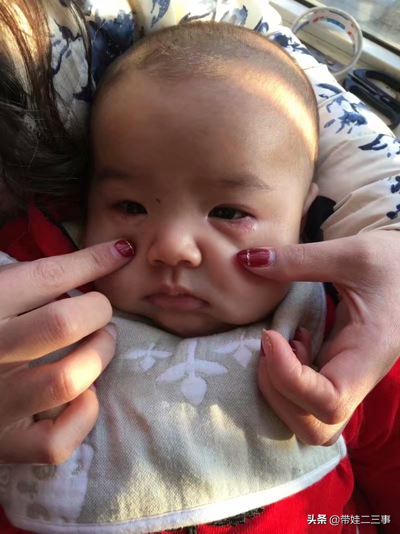 婴儿检查牛奶没过敏实际过敏,未满月的宝宝过敏怎么办