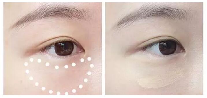 选择什么遮瑕可以遮住黑眼袋,男士遮瑕遮眼袋用什么好