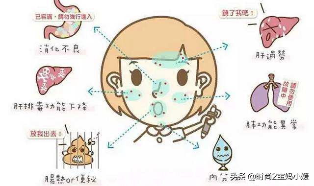 长痘并不可怕拯救痘痘肌,长痘痘了不要怕教你轻松一招解决