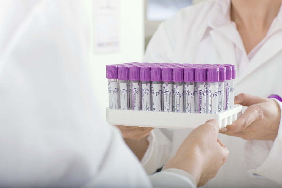 血流变检查结果多久出,血流变检查结果