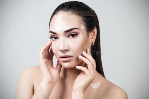 白癜风患者想要美白正常皮肤,白癜风患者可以打美白类水光吗