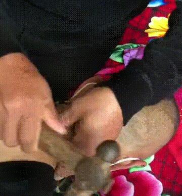 颈椎生理曲度过曲是啥意思,颈椎生理弯曲变直反弓怎么治疗